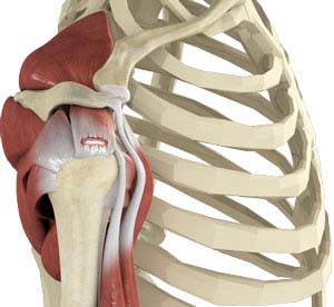 Rotator Cuff Tear St Louis  Arthroscopic Surgery O'Fallon, MO